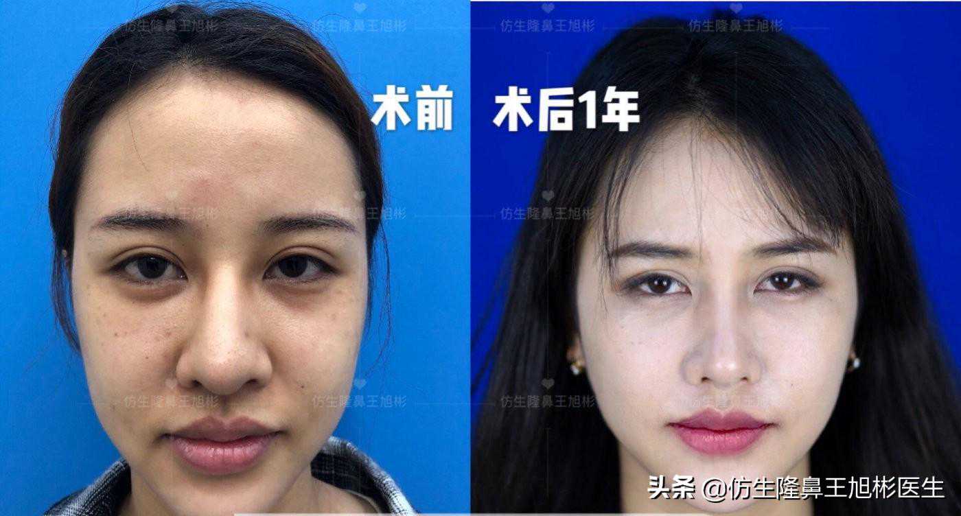 宇宙的安排是完美的，你只管但行好事，莫问前程，人生会越来越好